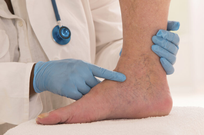 Want to know the benefits of elevating your legs? Read on!