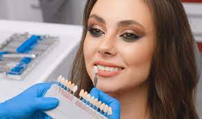 Understanding the Efficiency of Porcelain Veneers in Smile Enhancement